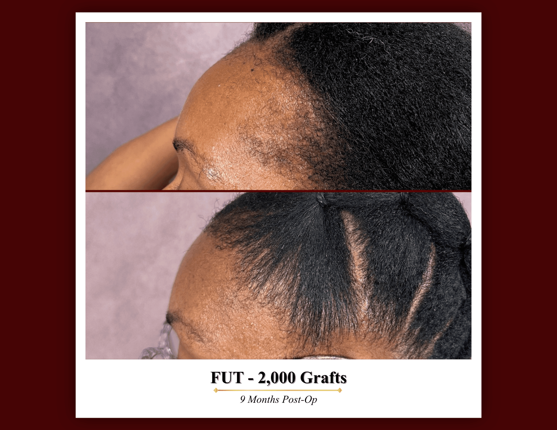 Procedure overview