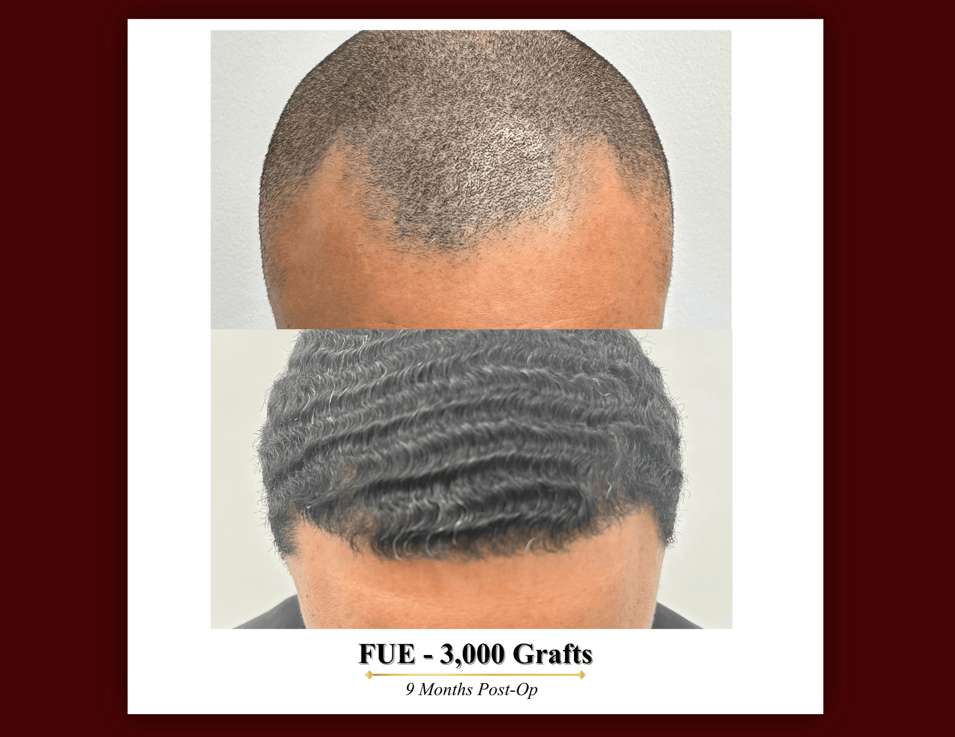 Patient result 5