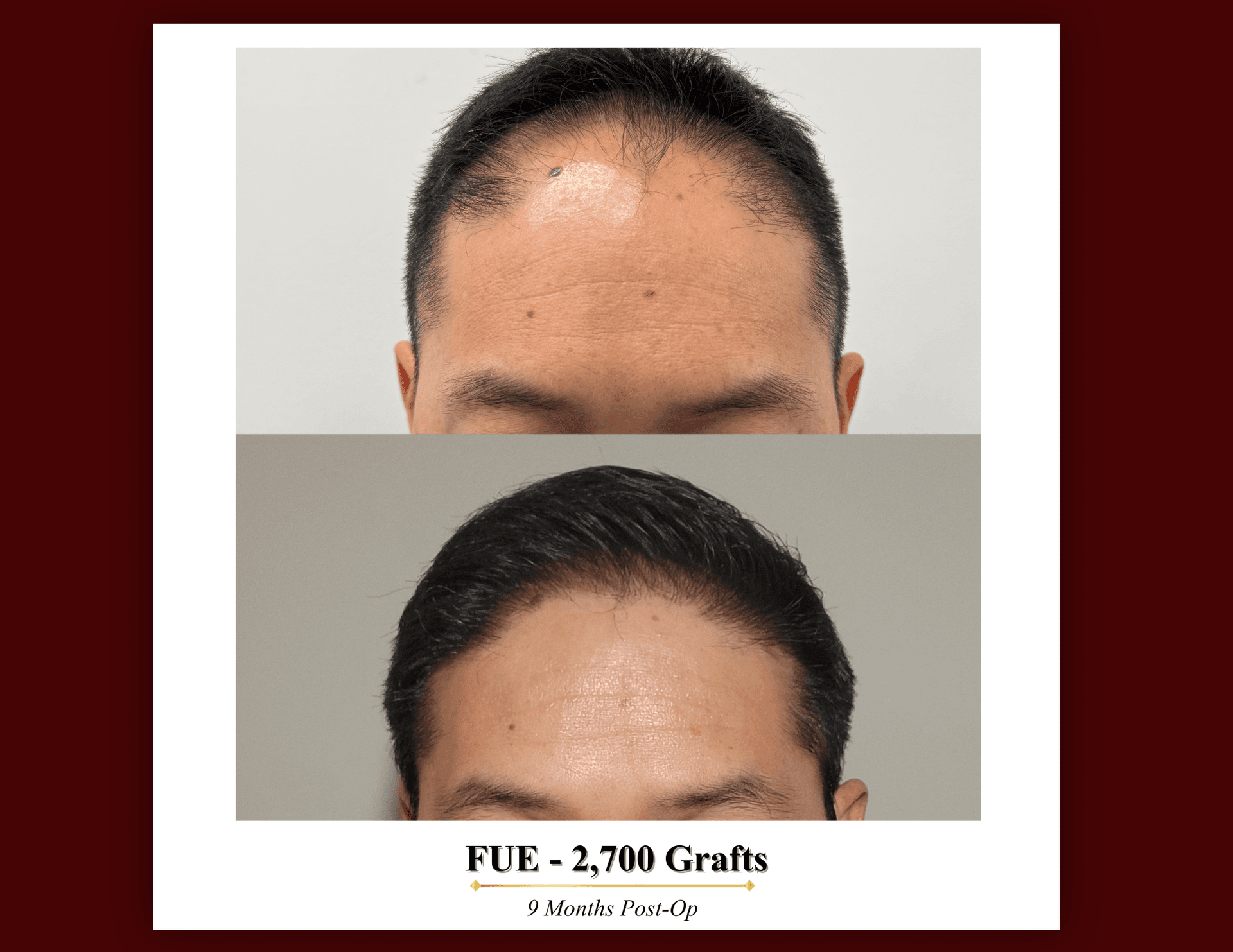 Patient result 1