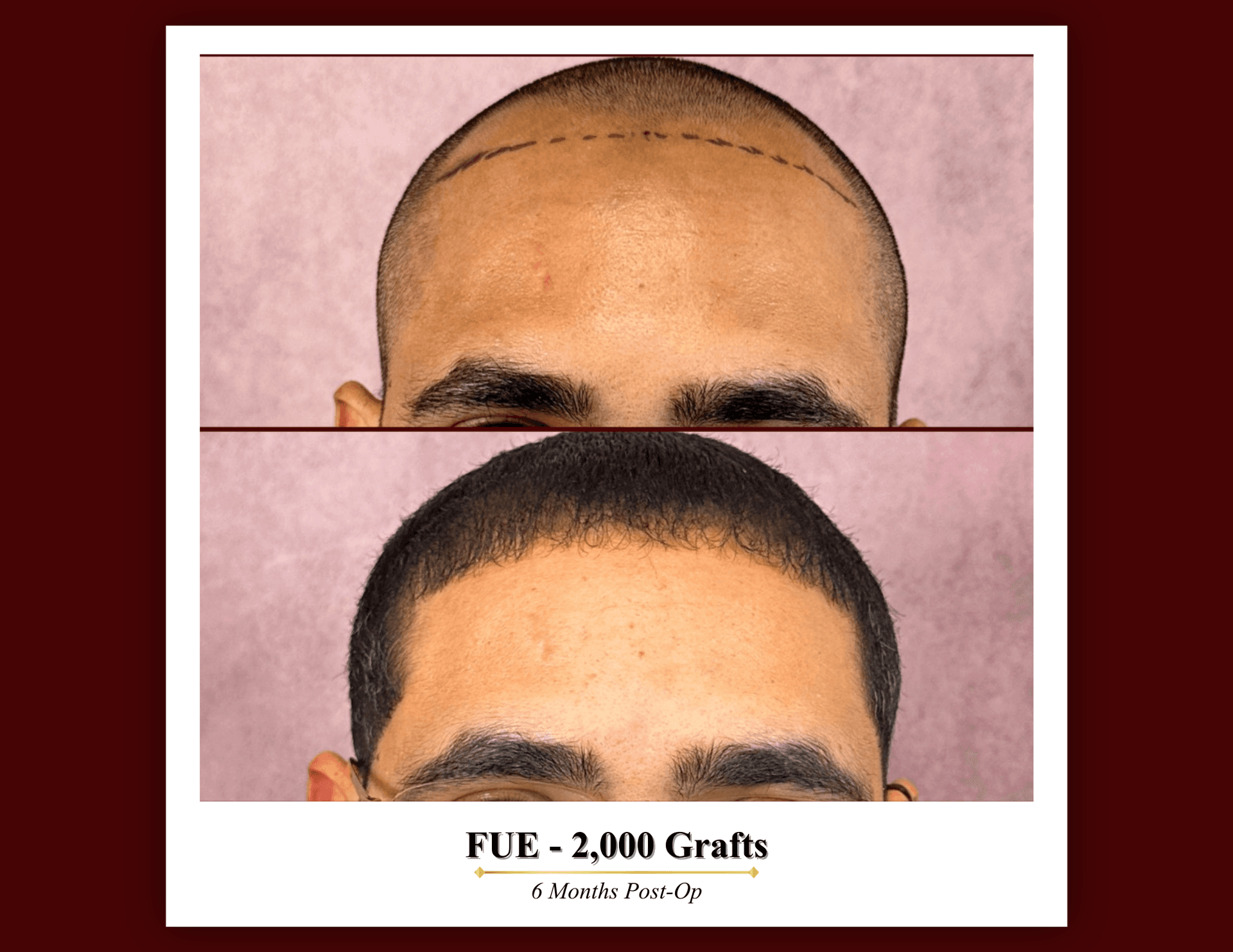 Patient result 3