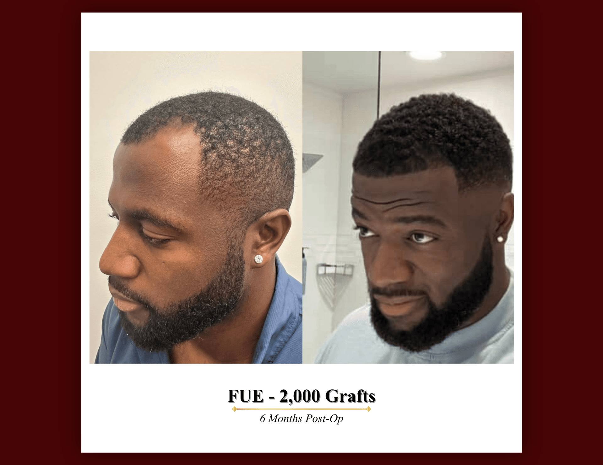 Patient result 2