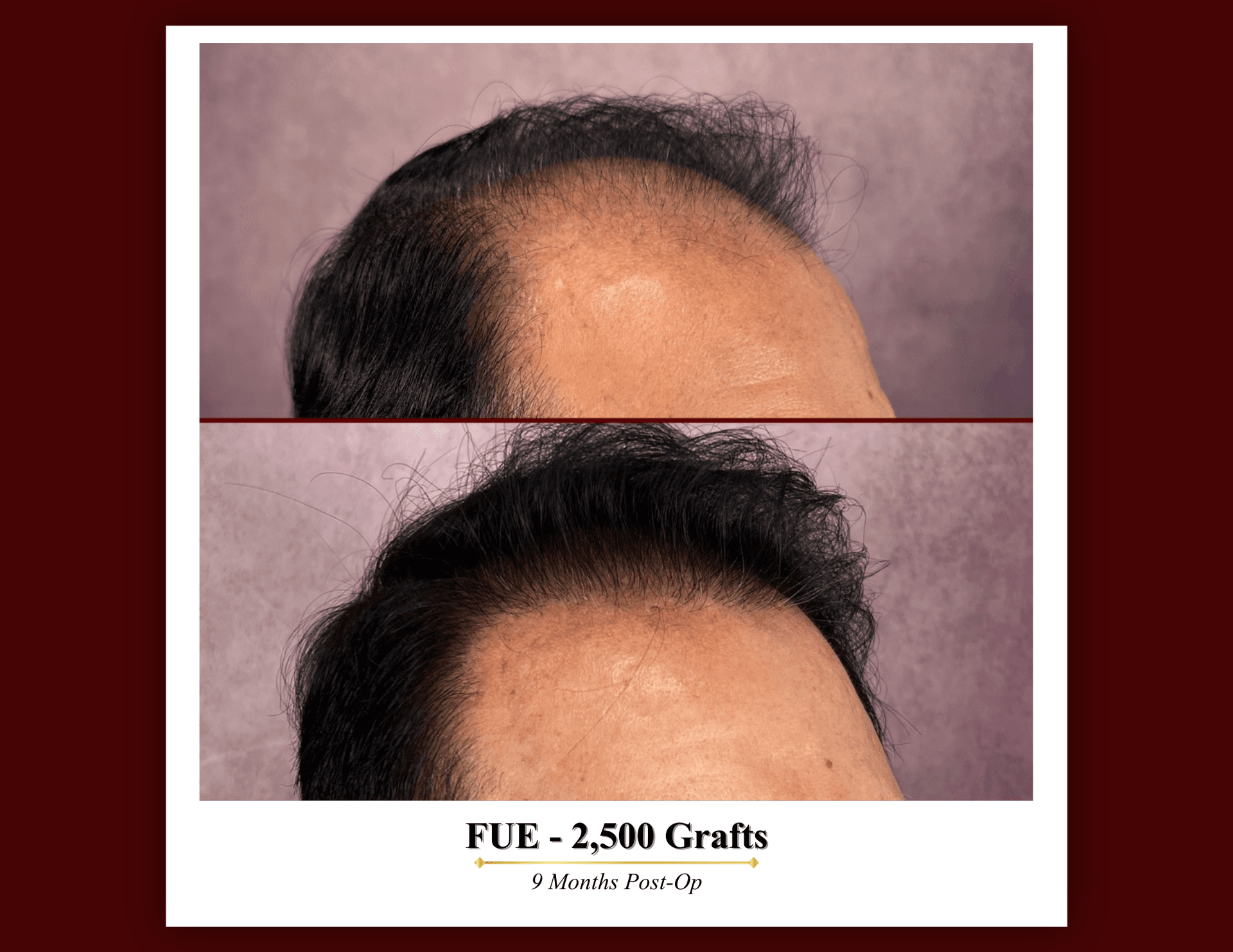 Patient result 4