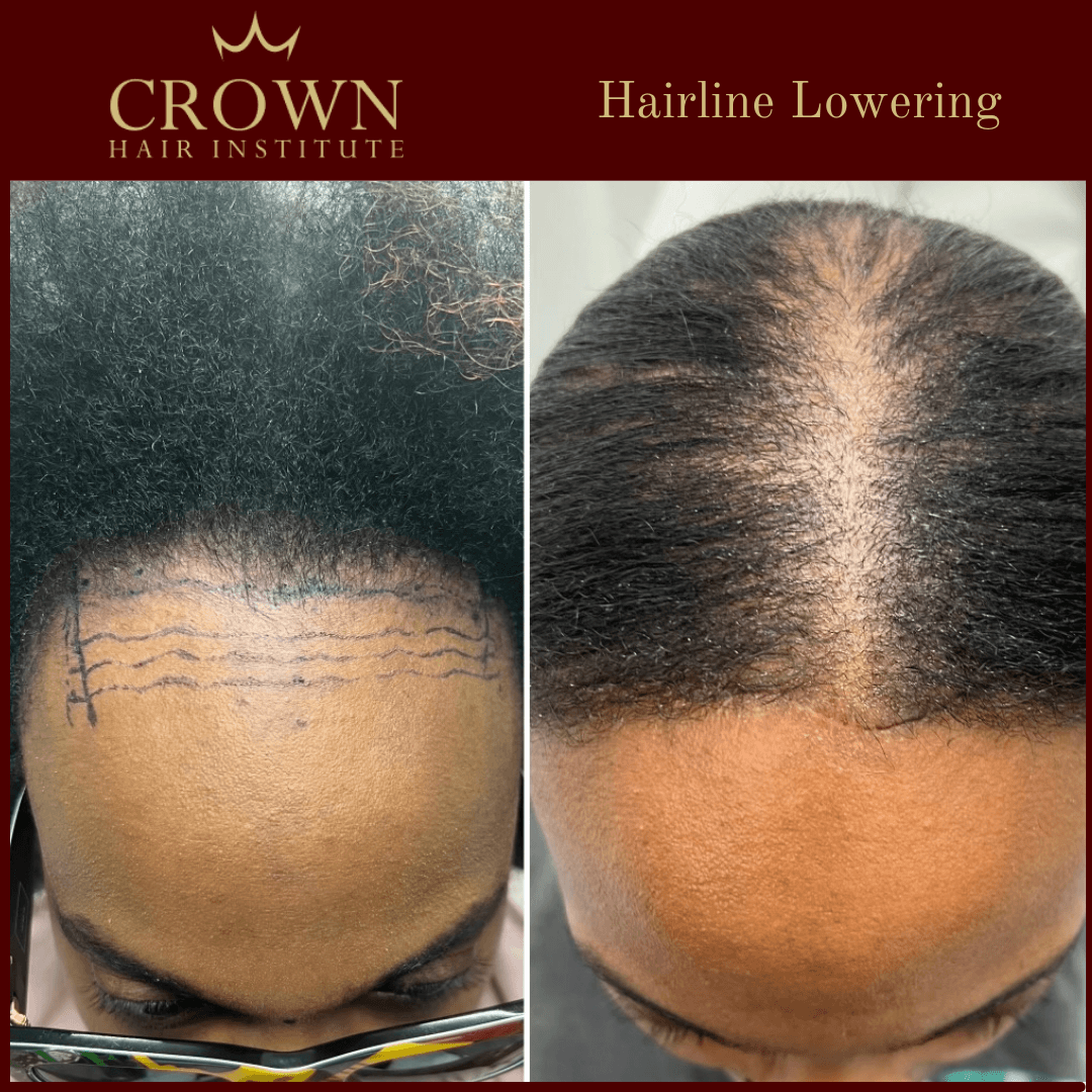 Patient result 22