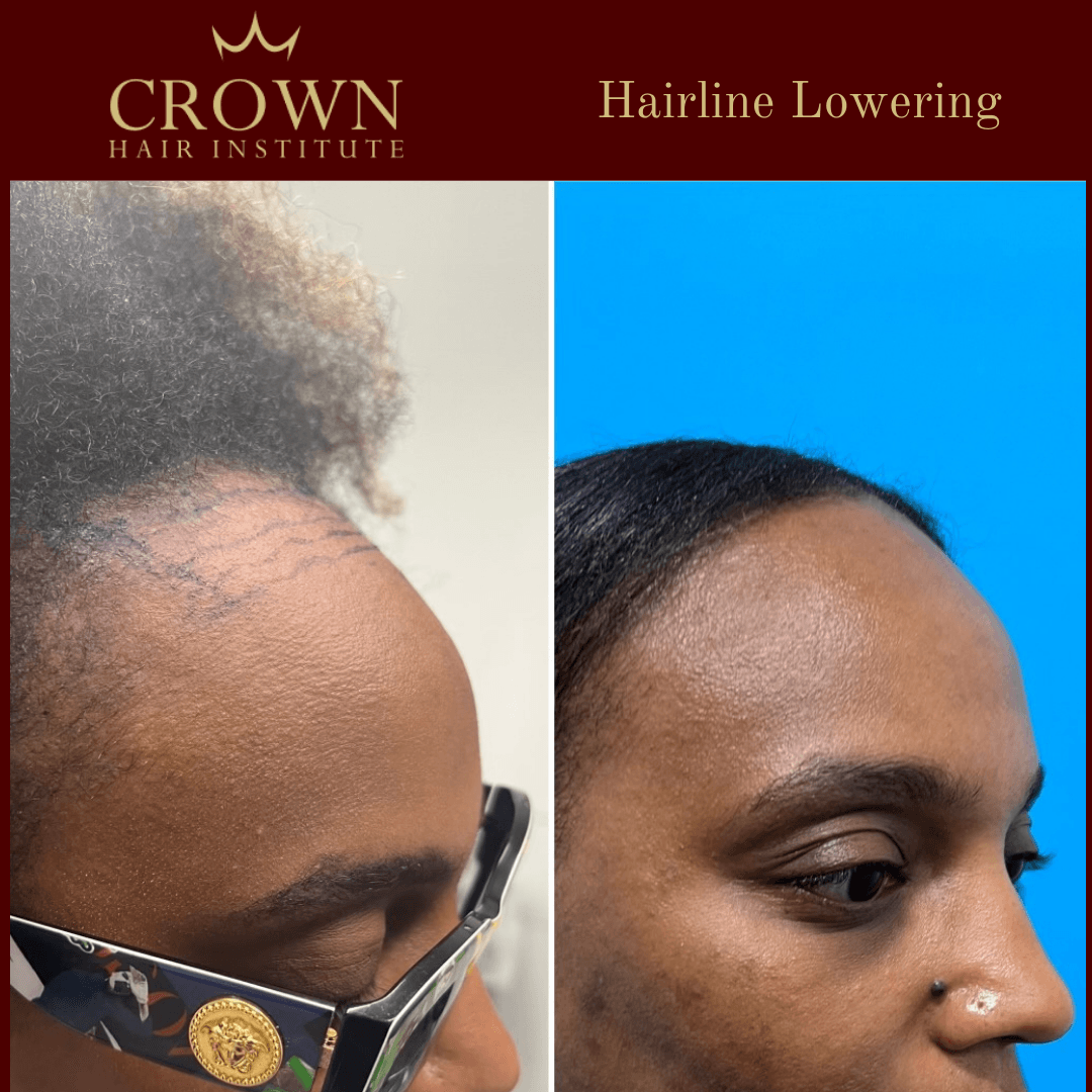 Patient result 23