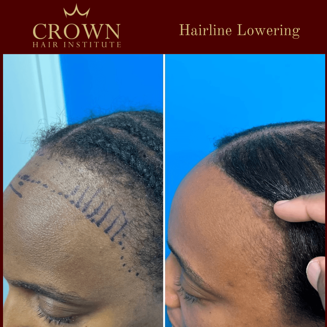 Patient result 24
