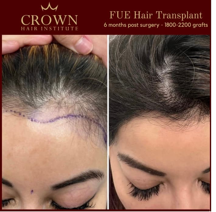 Patient result 25