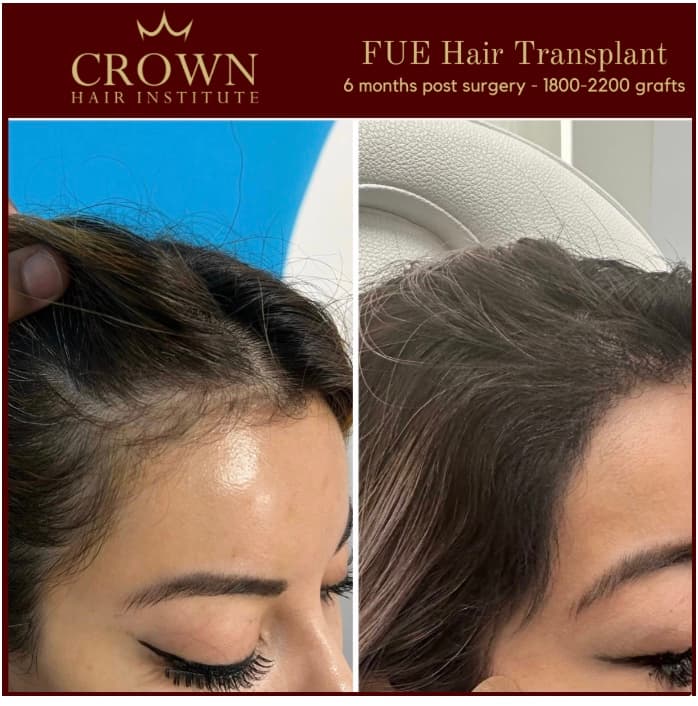 Patient result 26