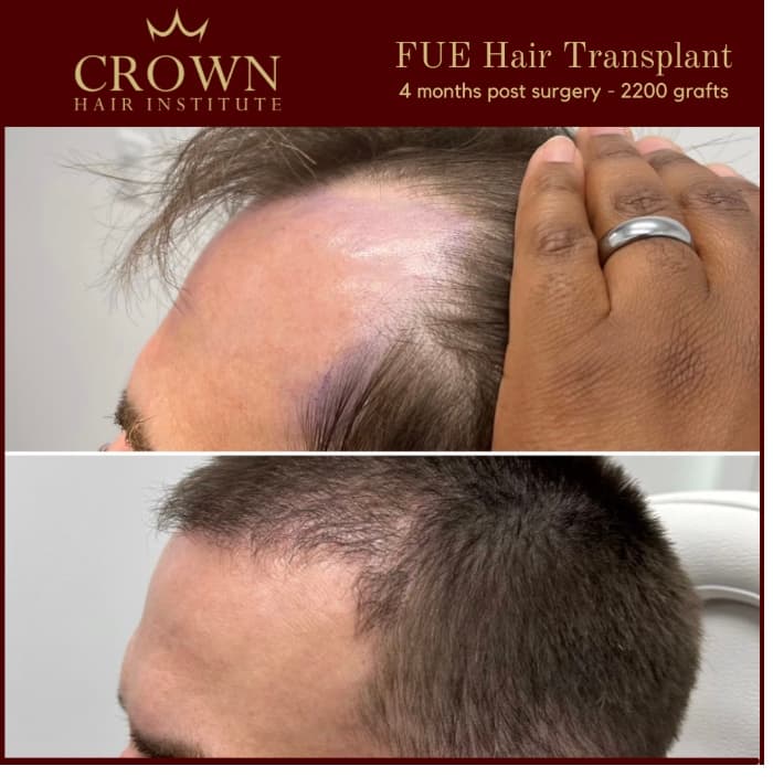 Patient result 27