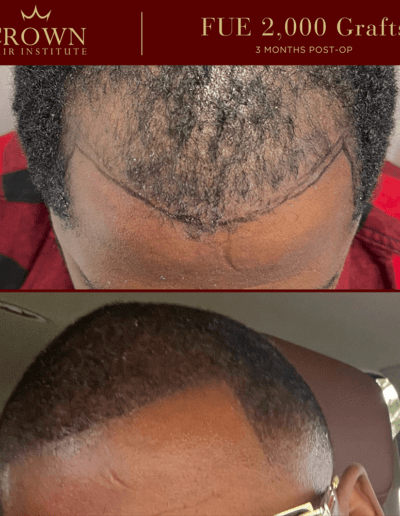 Patient result 3