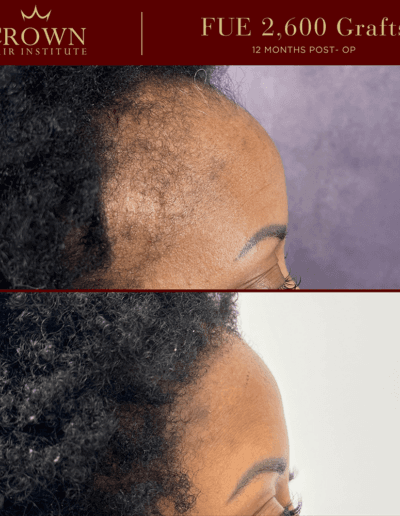 Patient result 5
