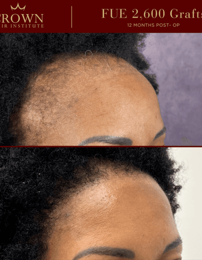 Patient result 6