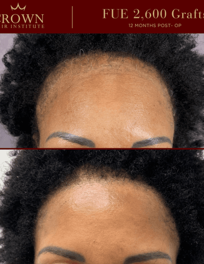 Patient result 7