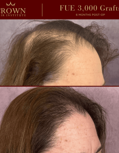 Patient result 8