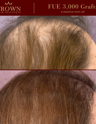 Patient result 9