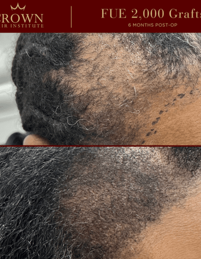 Patient result 10