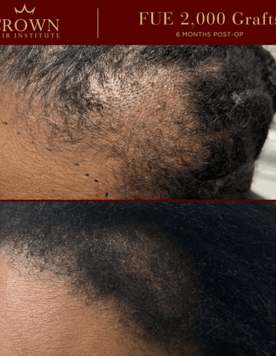 Patient result 11