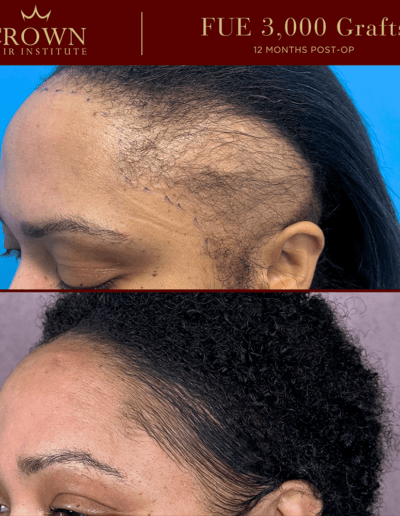 Patient result 13