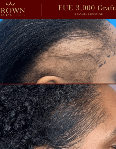 Patient result 14