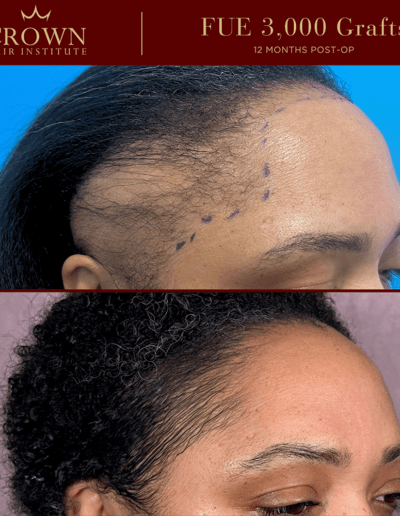 Patient result 15