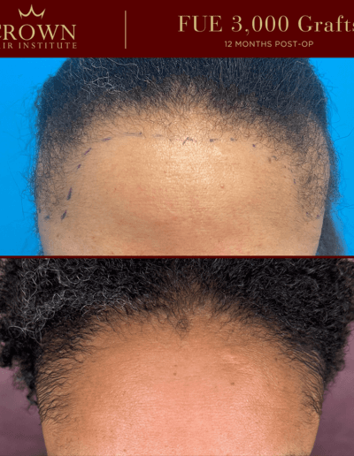 Patient result 16