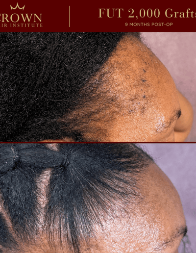 Patient result 17