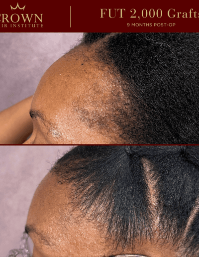 Patient result 18