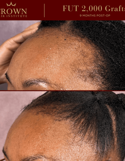 Patient result 19