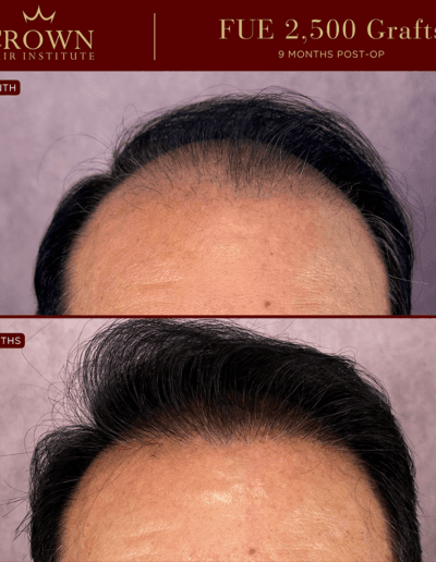 Patient result 20