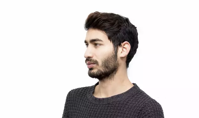Eyebrow Transplant